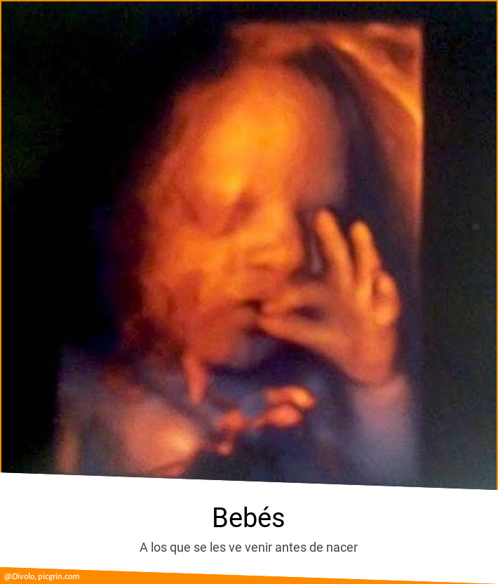 Bebés